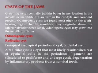 Odontogenic Cysts in Maxillofacial Region