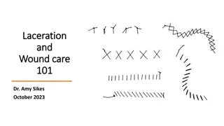 Essential Wound Care and Laceration Repair Guidelines