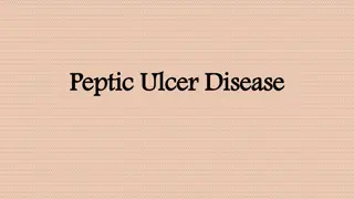 Peptic Ulcer Disease and Dyspepsia: Causes and Pathogenesis