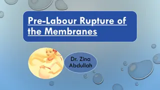 Clinical Diagnosis and Assessment of Pre-Labour Rupture of the Membranes