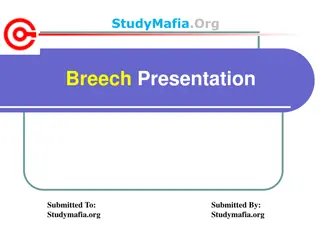 Breech Presentation in Pregnancy