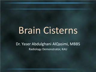 Understanding Brain Cisterns and Meninges in Radiology