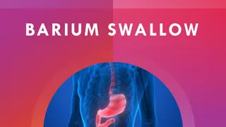 Comprehensive Guide to Barium Swallow Procedure