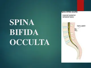 Understanding Spina Bifida Occulta: Symptoms, Causes, and Treatment