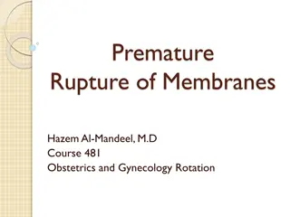 Premature Rupture of Membranes: Diagnosis and Management Overview