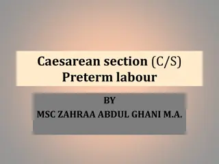 Cesarean Section and Preterm Labor Risks