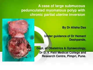 Large Submucous Pedunculated Myomatous Polyp with Chronic Partial Uterine Inversion