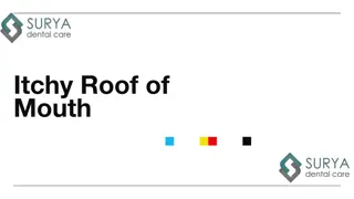 Itchy Roof of Mouth - Surya Dental Care