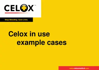 Life-saving Intervention with Celox: Real-life Examples and Success Stories