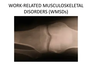 Understanding Work-Related Musculoskeletal Disorders (WMSDs)