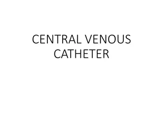 Central Venous Catheters: Uses, Placement, and Indications