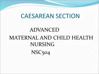 Comprehensive Overview of Caesarean Section and Uterine Anatomy