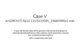 Genetic Findings in a Female Patient with Developmental Disorders