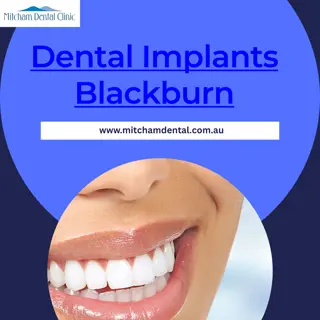 The Benefits of Choosing Mitcham Dental for Dental Implants in Blackburn