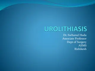 Understanding Urolithiasis: Causes, Diagnosis, and Management