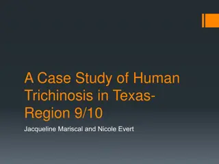 Case Study of Human Trichinosis in Texas Region