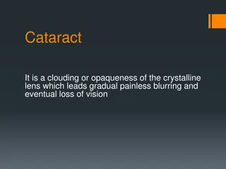 Cataracts: Causes, Effects, and Treatment