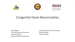 Congenital Hand Abnormalities and Associated Syndromes