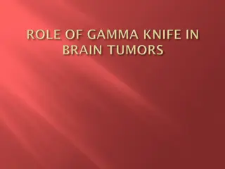 Gamma Knife Stereotactic Radiosurgery