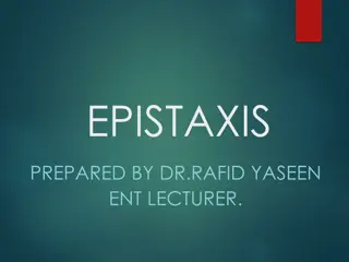 Epistaxis: Causes, Assessment, and Management