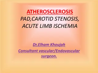 Atherosclerosis, Peripheral Artery Disease, and Carotid Stenosis