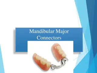 Understanding Mandibular Major Connectors in Dentistry