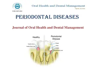 Periodontal Diseases and Their Management