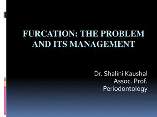 Furcation: Management Strategies in Periodontology