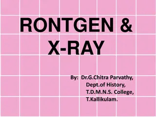 The Discovery and Impact of X-Ray by Wilhelm Conrad Rontgen