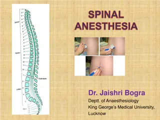 An Overview of Spinal Anesthesia in Regional Anesthesia Practice