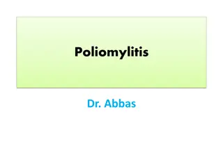 Poliomyelitis: A Comprehensive Overview of the Disease