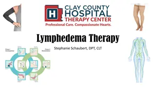 Understanding Lymphedema Therapy and Treatment Options