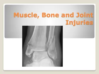 Understanding Muscle, Bone, and Joint Injuries: Care and Treatment