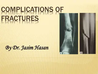 Complications of Fractures and Their Management by Dr. Jasim Hasan