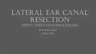 Lateral Ear Canal Resection (Zepp's Operation) by Dr. Gulshan Kumar