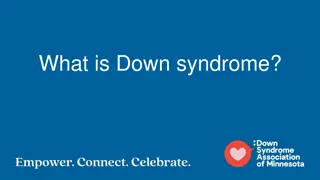 Down Syndrome: Causes, Effects, and Characteristics