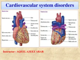 Acute Coronary Syndromes: Causes, Symptoms, and Risk Factors