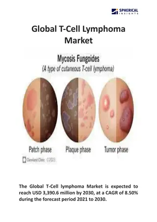 Global T-Cell Lymphoma Market