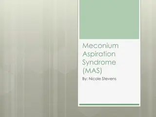 Meconium Aspiration Syndrome (MAS) in Newborns