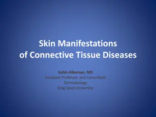 Skin Manifestations of Connective Tissue Diseases - Lecture Highlights