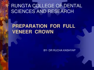 Full Veneer Crown: Types, Indications, and Preparation in Dental Sciences