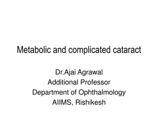 Metabolic and Complicated Cataracts: Classification and Subtypes