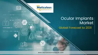 Ocular Implants Market