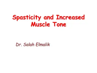 Spasticity and Increased Muscle Tone in Neurological Disorders