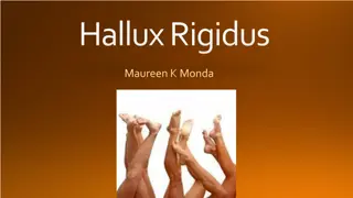 Hallux Rigidus: Anatomy, Biomechanics, and Epidemiology