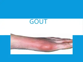 Understanding Gout: Causes, Symptoms, and Management