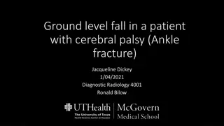 Ankle Fracture in a Patient with Cerebral Palsy: Diagnostic Radiology Case Study