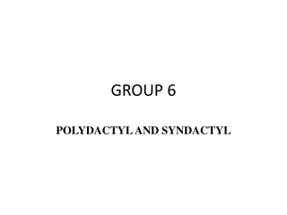 Polydactyly and Syndactyly: Genetic Anomalies in Limb Development