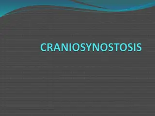 Craniosynostosis: Premature Fusion of Cranial Sutures