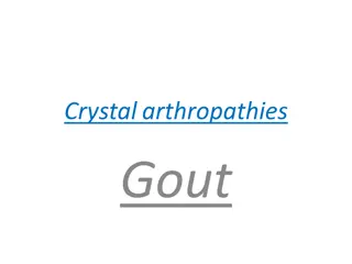 Understanding Crystalarthropathies and Gout: A Comprehensive Overview